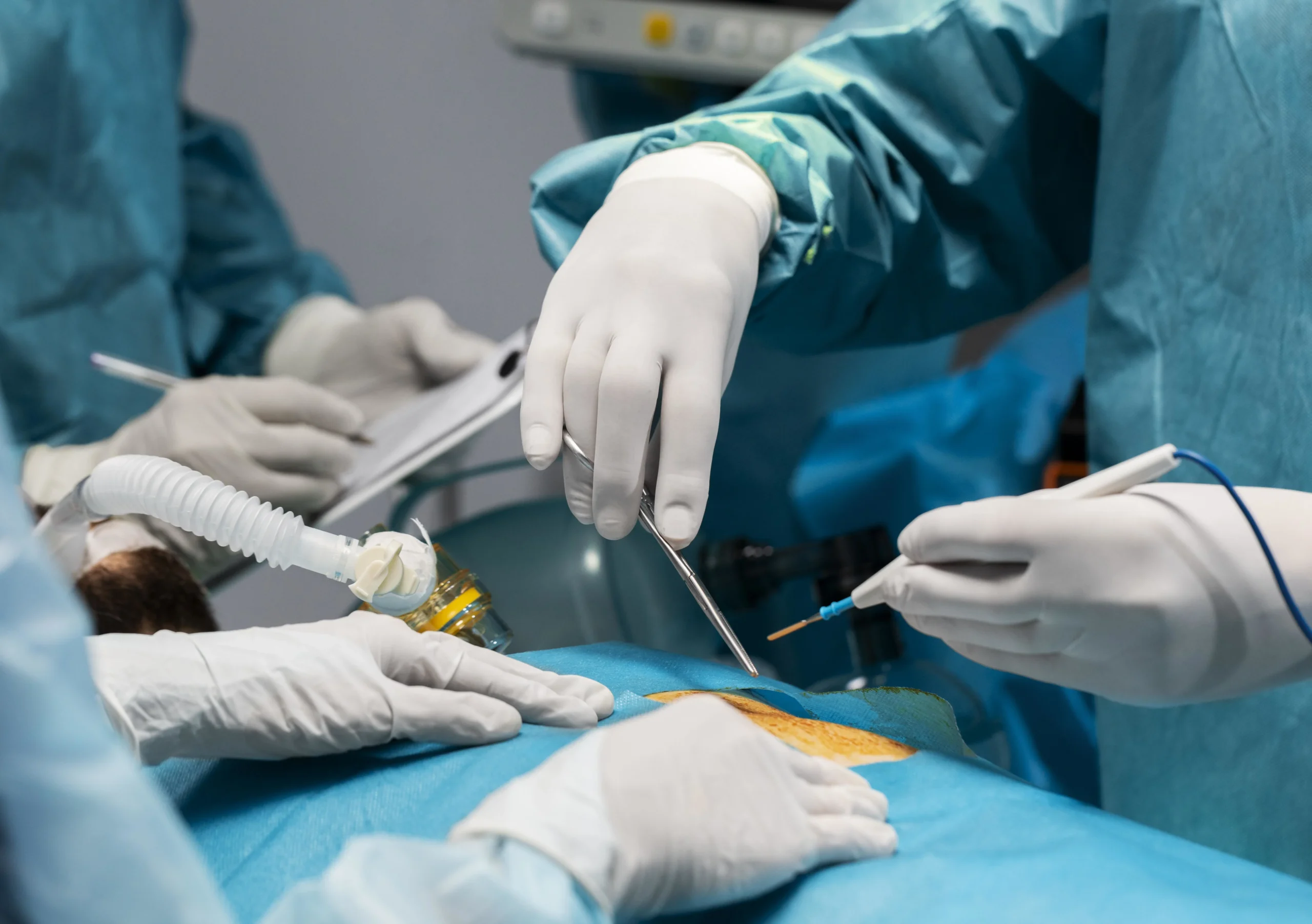 Laparoscopic Procedures